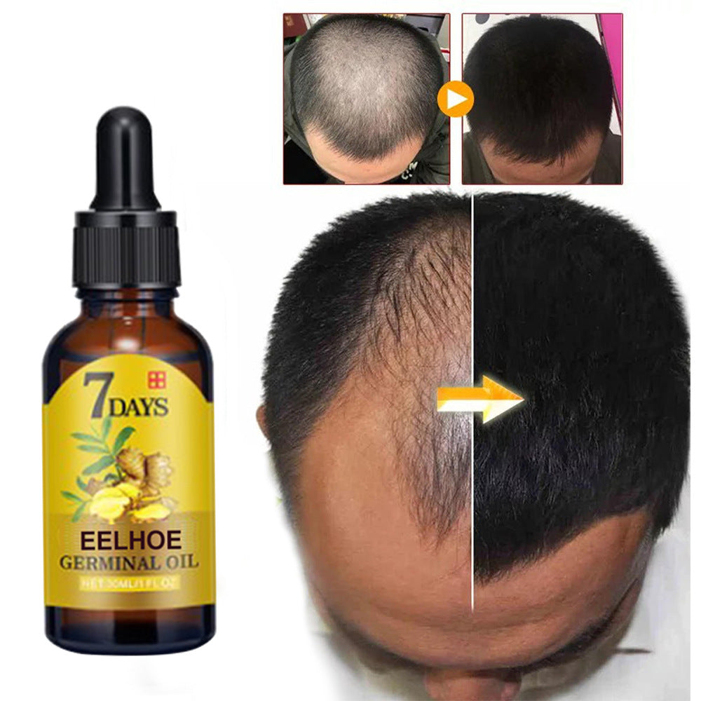 NOURISHING MOISTURIZING ANTI-HAIR LOSS GINGER SOLUTION – THICK HAIR