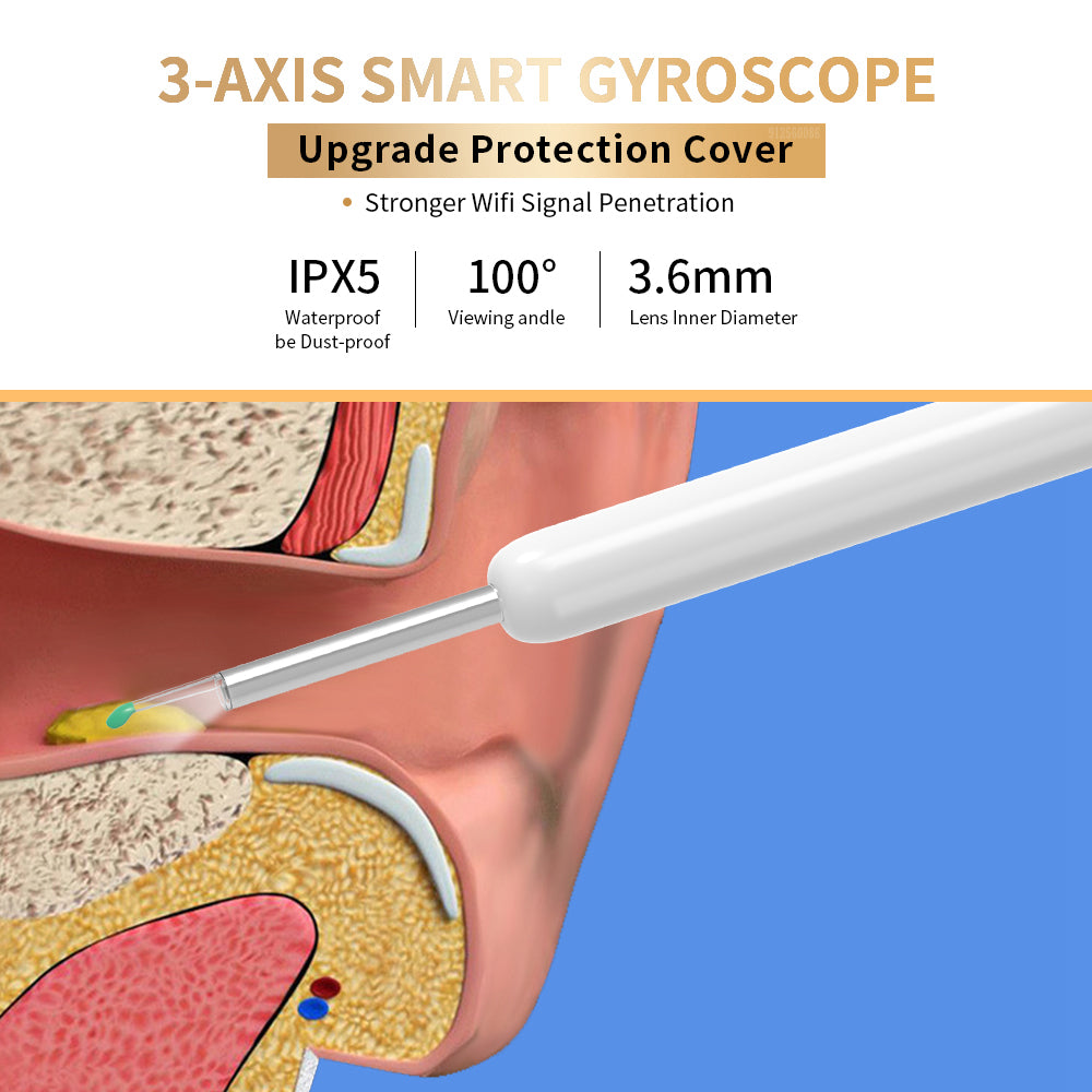 Nettoyeur d’oreilles NE3 avec caméra LED – otoscope sans fil iPhone Android