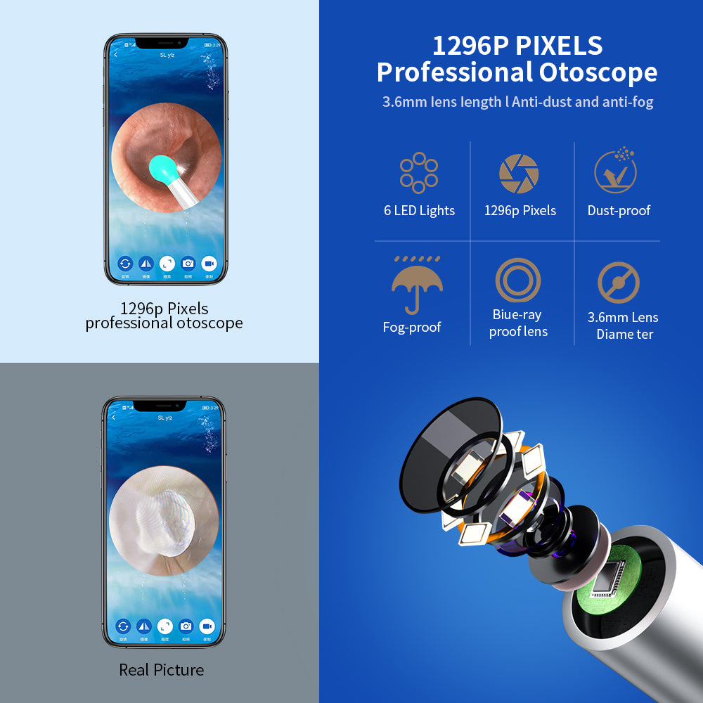 Nettoyeur d’oreilles NE3 avec caméra LED – otoscope sans fil iPhone Android